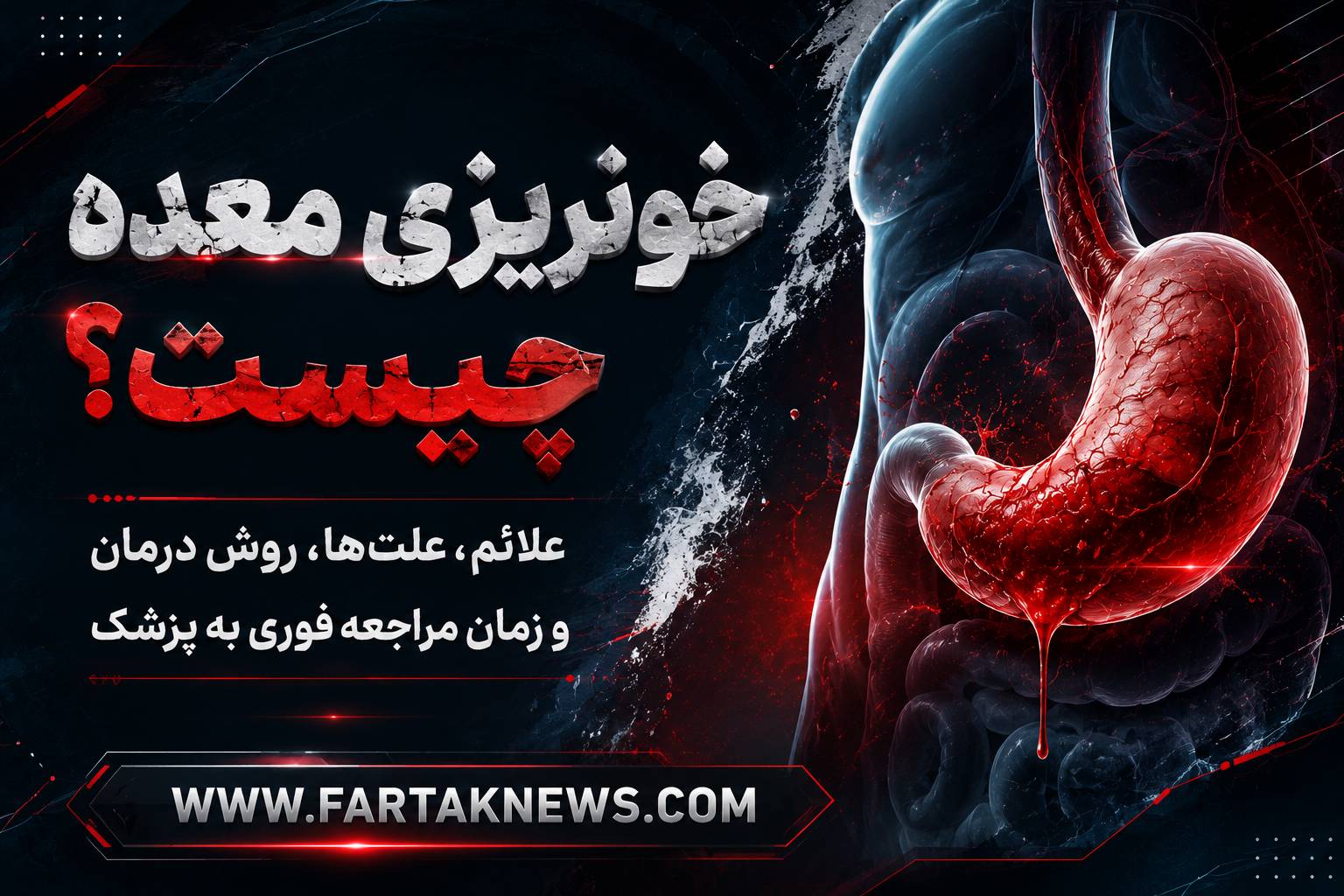 خونریزی معده