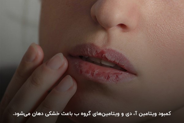 174917000b6bd5872ca8