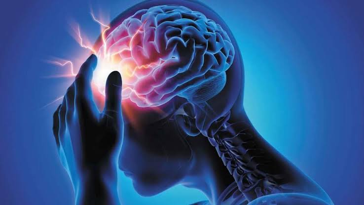 آنسفالیت خودایمنی
