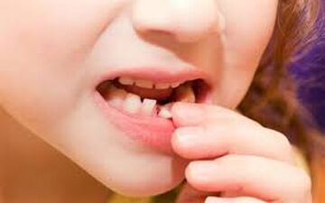 دندان های کودکانتان را حتما بررسی کنید!