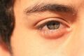 پف و تیرگی زیر چشم؛ دلایل و راهکارهای ساده برای داشتن چشم‌هایی شاداب