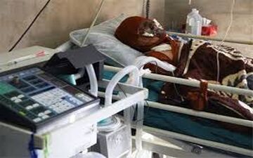فوت 26 نفر بر اثر سوختگی در پنج ماهه سال جاری در کرمانشاه



