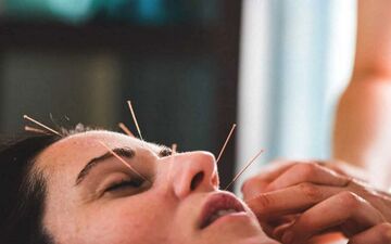 طب سوزنی صورت چگونه باعث جوان‌سازی پوست می‌شود؟