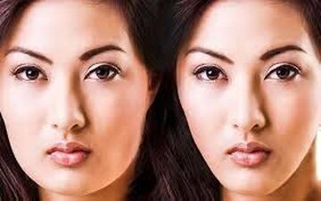 اگر به دنبال راهی برای چاقی صورت هستید این مطلب را بخوانید!