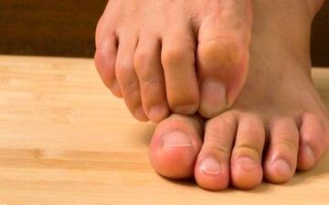 13 علت احتمالی برای بی‌حسی و گزگز پاها 
