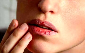 علت خشکی دهان و ۹ راهکار برای برطرف کردن آن