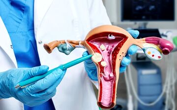 همه چیز درباره فیبروم رحم؛ علائم، خطرات و راه‌های درمان