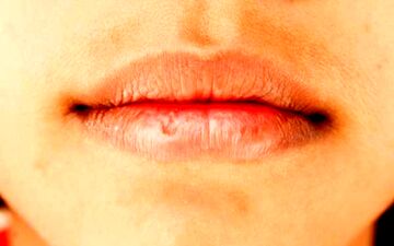 چند توصیه کاربردی برای جلوگیری از خشکی و ترک لب در ماه رمضان
