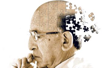 تغییرات شدید وزنی از عوامل خطر زوال عقل