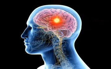 زنگ خطرهای پنهان؛ وقتی تومور مغزی خودش را پشت علائم ساده قایم می‌کند!