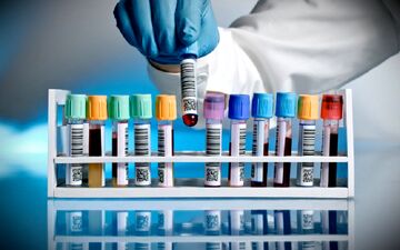 آزمایش عدم اعتیاد و هر آنچه در مورد آن باید بدانیم