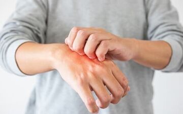 علائم هشدار دهنده این بیماری روی پوست