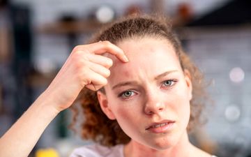 علت خارش پیشانی چیست و چه زمانی باید به پزشک مراجعه کنیم؟