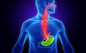 علائم ریفلاکس معده را بشناسید 