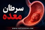 علائم سرطان معده؛ چه زمانی سوءهاضمه می‌تواند زنگ خطر باشد؟