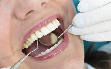 چه زمانی به متخصص ارتودنسی مراجعه کنیم؟