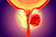 مشکلات شایع در مردان بالای ۴۵ سال