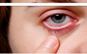 باکتری پنهان در چشم، احتمالاً محرک بیماری آلزایمر است
