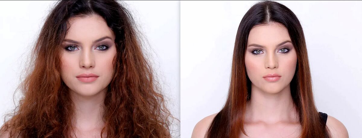 وزی مو را چطوری از بین ببریم؟