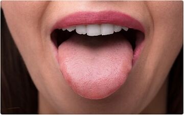 زبان شما می تواند وضعیت احساسات و سلامت شما را آشکار کند