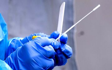 
جواب تست PCR قابل اطمینان است؟