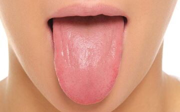 ضایعه کوچک دهانی خطرناک اند؟