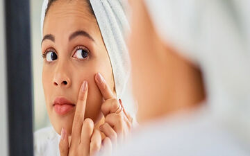جوش هر ناحیه صورت نشانه چیست؟