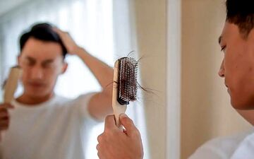 چطور ریزش شدید موها را کنترل کنیم؟
