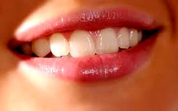 مراقبت از لثه با تغذیه مناسب