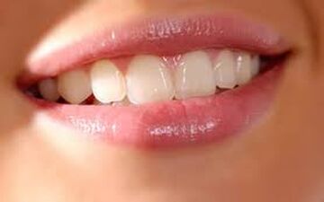 مراقبت از لثه با تغذیه مناسب