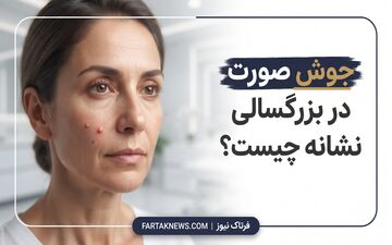 جوش صورت در بزرگسالی نشانه چیست؟ راهنمای بررسی و اقدام‌های اولیه