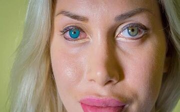 عمل زیبایی عجیب و باورنکردنی خانم مانکن مشهور + عکس ها