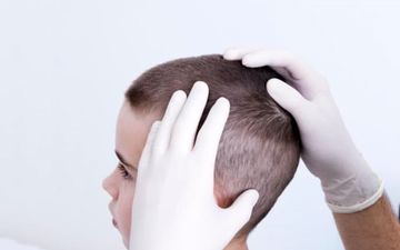 حشره ریزی که بلای موی سر می شود