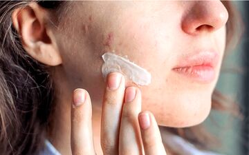 از بین بردن لک صورت با خمیر دندان؛ واقعیت یا یک باور غلط؟