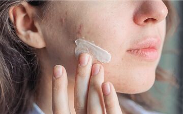 از بین بردن لک صورت با خمیر دندان؛ واقعیت یا یک باور غلط؟