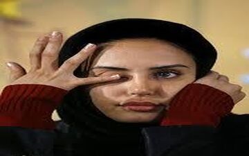 الناز شاکردوست با پاهایی شکسته!
