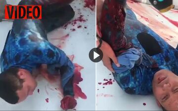 نجات غواص زخمی پس از حمله مرگبار کوسه