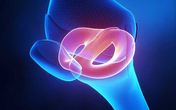 عوارض شکستن قولنج چیست؟