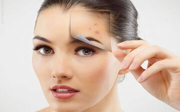  جای جوش روی بدنت اذیتت میکنه؟ بیا بهت بگم چه طوری از بین ببری!