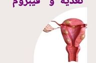 ارتباط بین ویتامین D و فیبروم چیست؟