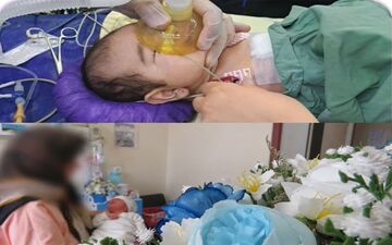 نجات نوزاد ۲ماهه با پارگی طحال در سمنان