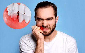 چرا مردان بیشتر از زنان به بیماری‌های دهان و دندان مبتلا می‌شوند؟