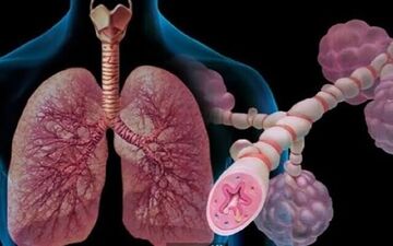  افراد مبتلا به آسم شدید چه مشکلات جسمی دیگری دارند؟