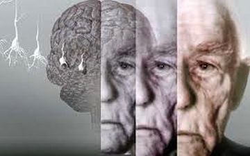 علائمی که خبر از شروع آلزایمر می دهد