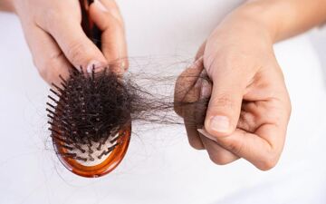 رازهای تشخیص ریزش موی طبیعی از غیرطبیعی