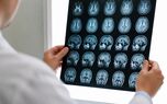 چرا بعضی سرطان‌ها در مراحل اولیه علامتی آشکار ندارند