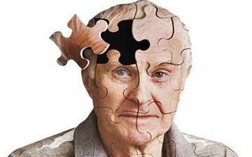 برای فرار از آلزایمر چه کنیم؟