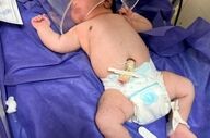 تولد نوزاد فوق سنگین در کرمانشاه!/ نوزاد ۵ کیلو و ۶۵۰ گرمی چشم به جهان گشود