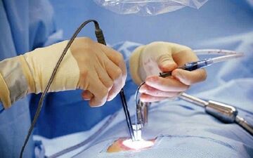 عمل لاپاراسکوپی چیست و چگونه انجام می‌شود؟
