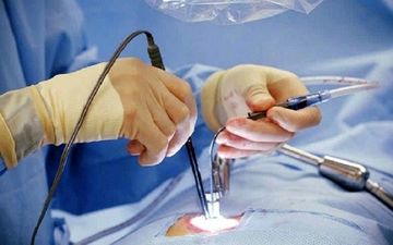 عمل لاپاراسکوپی چیست و چگونه انجام می‌شود؟